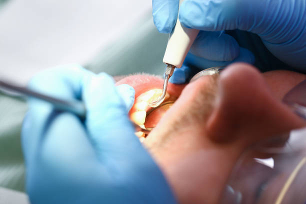 Best Emergency Dental Services for Seniors in Thonotosassa, FL