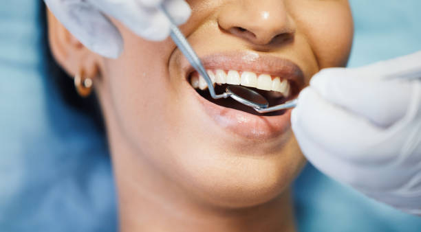 Best Emergency Dental Services for Seniors in Thonotosassa, FL